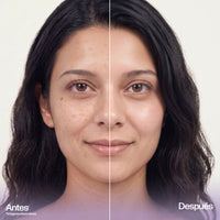 Crema Facial Blanqueadora