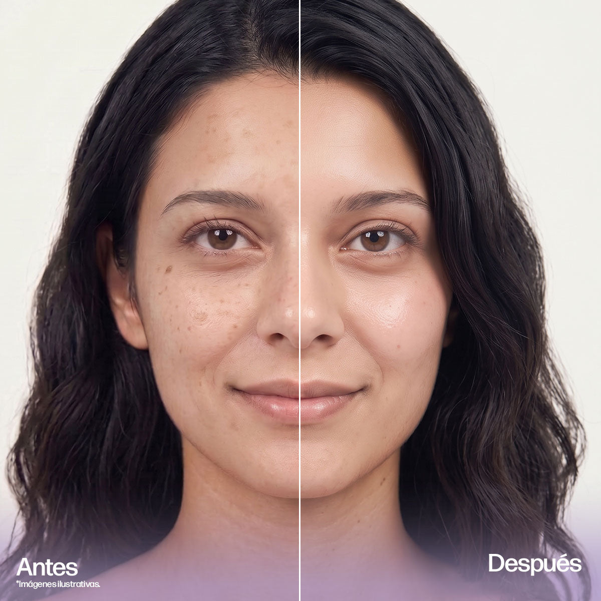 Crema Facial Blanqueadora